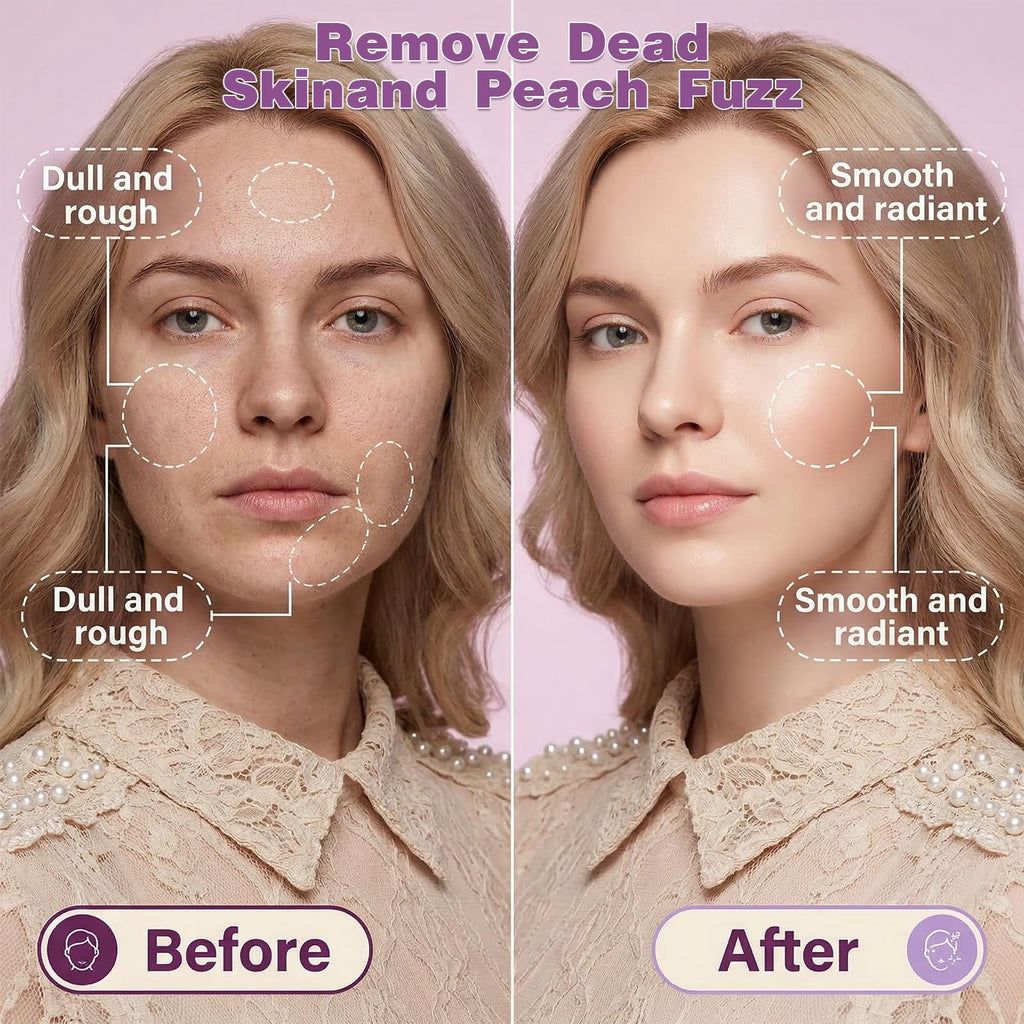 Sonic Dermaplaning Tool for Women Rechargeable Face Dermaplane Razor with Sonic Edge Technology for FacialHair Peach Fuzz & Exfoliation Removal LED Light 3 Speeds 13 Refill Blades